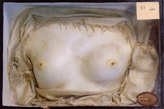 Illustration for article titled The Lost Science of Human Petrification